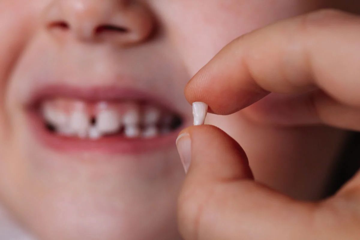 Видалення молочних зубів – як зробити все правильно й не нашкодити дитині?